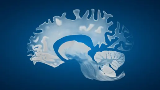 Alcohol Use Disorder Can Lead to a Deadly Memory Disorder, Study Finds